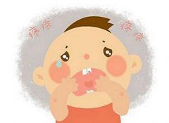 宝宝嘴里长红泡 可别把口腔炎当成手口病