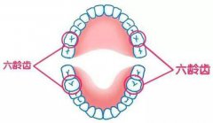 中华牙科网：6成儿童蛀牙都发生在这牙上！