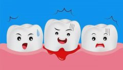 牙龈出血、口臭……口腔细菌会让你掉牙！
