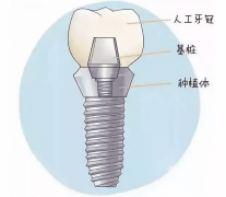 种植的流程和价钱是什么？