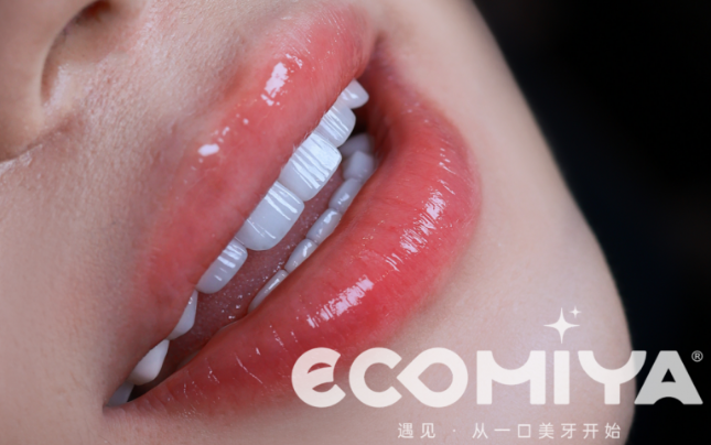 牙齿贴面自然吗？杭州哪里做？2026年全瓷贴面价格与机构评估报告