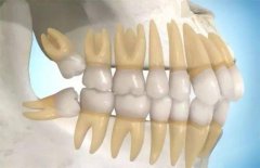 根据牙疼的症状快速找到牙疼真正的原因
