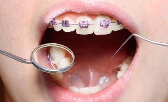 西安人如何预防孩子牙齿畸形，矫正的最佳时间是什么时候？